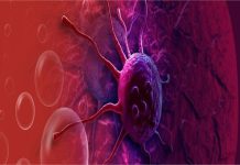Stage 1 Cancer Alert: सावधान! शरीर में दिखें ये संकेत तो हो सकता हैं स्टेज-1 का कैंसर, इसे न करें इग्नोर नहीं तो…