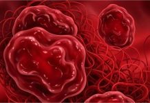 महिलाएं न करें लापरवाही: क्यों बनते हैं Periods में Blood Clots? जानिए कब यह सामान्य है और कब खतरनाक?