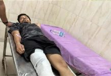 शॉर्ट एनकाउंटर: पुलिसवाले को दांत से काटा, अंधेरे में भागा; टांग में गोली खाकर अस्पताल पहुंचा 30 केसों का वांटेड बदमाश!
