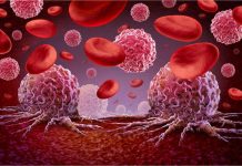 Early Warning Signs of Cancer: कैंसर के 5 ऐसे लक्षण खतरे की घंटी, भूलकर भी न करें नजरअंदाज